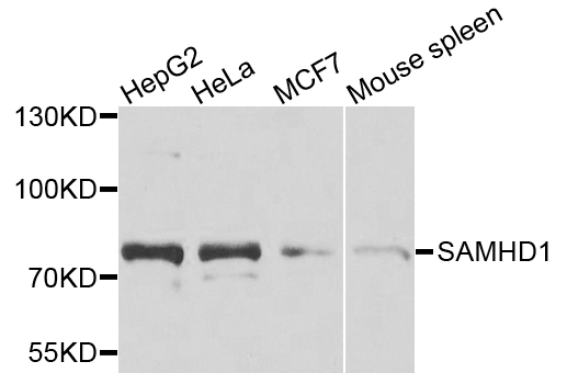 SAMHD1 Antibody - Western blot analysis of extracts of various cells.