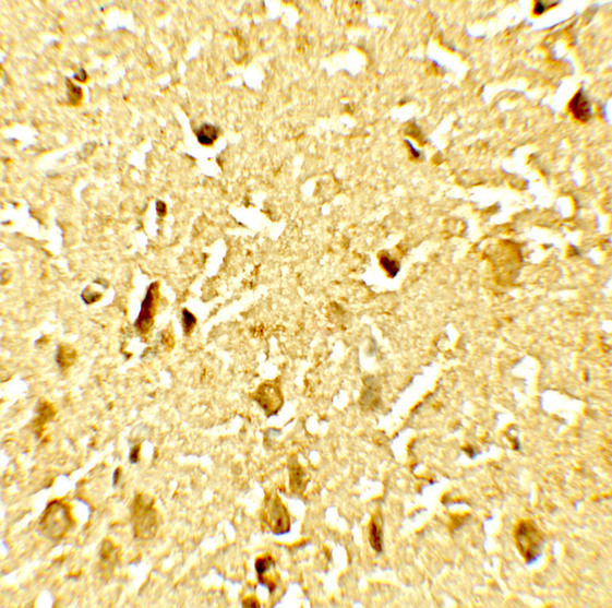 SAMHD1 Antibody - Immunohistochemistry of SAMHD1 (phospho Thr592) in human brain tissue with SAMHD1 (phospho Thr592) antibody at 2.5 ug/ml.