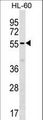 SAMM50 Antibody - SAMM50 Antibody western blot of HL-60 cell line lysates (35 ug/lane). The SAMM50 antibody detected the SAMM50 protein (arrow).