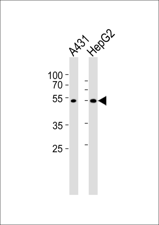 SAMM50 Antibody - Western blot of lysates from A431, HepG2 cell line (from left to right) with SAMM50 Antibody. Antibody was diluted at 1:1000 at each lane. A goat anti-rabbit IgG H&L (HRP) at 1:5000 dilution was used as the secondary antibody. Lysates at 35 ug per lane.