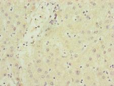 SAMM50 Antibody - Immunohistochemistry of paraffin-embedded human liver cancer at dilution of 1:100