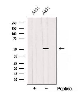 SAMM50 Antibody - Western blot analysis of extracts of A431 cells using SAMM50 antibody. The lane on the left was treated with blocking peptide.