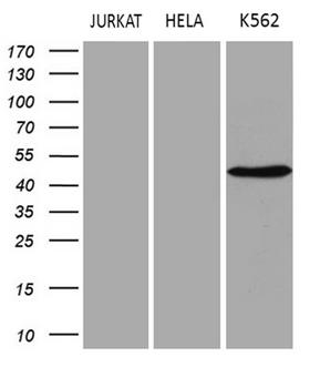 SAMSN1 Antibody - Western blot analysis of extracts. (35ug) from 3 different cell lines by using anti-SAMSN1 monoclonal antibody. (1:500)