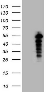 SAMSN1 Antibody - HEK293T cells were transfected with the pCMV6-ENTRY control. (Left lane) or pCMV6-ENTRY SAMSN1. (Right lane) cDNA for 48 hrs and lysed. Equivalent amounts of cell lysates. (5 ug per lane) were separated by SDS-PAGE and immunoblotted with anti-SAMSN1. (1:2000)