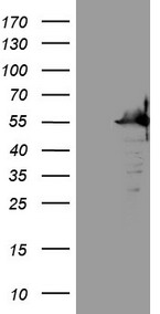 SAMSN1 Antibody - HEK293T cells were transfected with the pCMV6-ENTRY control. (Left lane) or pCMV6-ENTRY SAMSN1. (Right lane) cDNA for 48 hrs and lysed. Equivalent amounts of cell lysates. (5 ug per lane) were separated by SDS-PAGE and immunoblotted with anti-SAMSN1. (1:2000)