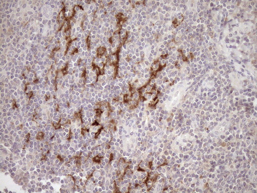 SAMSN1 Antibody - Immunohistochemical staining of paraffin-embedded Human tonsil within the normal limits using anti-SAMSN1 mouse monoclonal antibody. (Heat-induced epitope retrieval by 1mM EDTA in 10mM Tris buffer. (pH8.5) at 120°C for 3 min. (1:150)