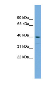 SAMSN1 Antibody - SAMSN1 antibody Western blot of MCF7 cell lysate. This image was taken for the unconjugated form of this product. Other forms have not been tested.