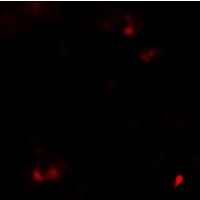 SAMSN1 Antibody - Immunofluorescence of SAMSN1 in HeLa cells with SAMSN1 antibody at 5 µg/ml.