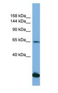 SAP130 Antibody - SAP130 antibody Western Blot of Jurkat. Antibody dilution: 1 ug/ml.  This image was taken for the unconjugated form of this product. Other forms have not been tested.