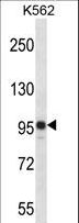 SAP130 Antibody - SAP130 Antibody western blot of K562 cell line lysates (35 ug/lane). The SAP130 antibody detected the SAP130 protein (arrow).