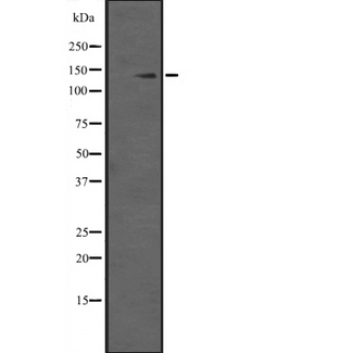 SAP130 Antibody - Western blot analysis of SAP130 expression in HepG2 (human hepatocellsular liver tissue carcinoma cells line) Whole cells Lysate. The lane on the left is treated with the antigen-specific peptide.
