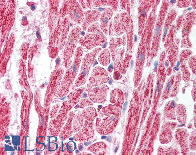 SAP18 Antibody - Anti-SAP18 antibody IHC of human heart. Immunohistochemistry of formalin-fixed, paraffin-embedded tissue after heat-induced antigen retrieval. Antibody concentration 5 ug/ml.  This image was taken for the unconjugated form of this product. Other forms have not been tested.