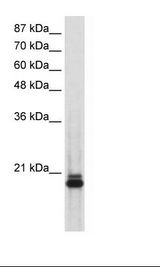 SAP18 Antibody - Transfected 293T Cell Lysate.  This image was taken for the unconjugated form of this product. Other forms have not been tested.