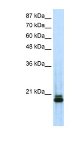 SAP18 Antibody - SAP18 antibody Western blot of Transfected 293T cell lysate. This image was taken for the unconjugated form of this product. Other forms have not been tested.