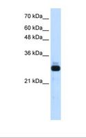 SAP30 Antibody - Transfected 293T cell lysate. Antibody concentration: 1.25 ug/ml. Gel concentration: 12%.  This image was taken for the unconjugated form of this product. Other forms have not been tested.