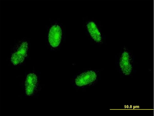 SAP30 Antibody - Immunofluorescence of monoclonal antibody to SAP30 on HeLa cell. [antibody concentration 10 ug/ml].