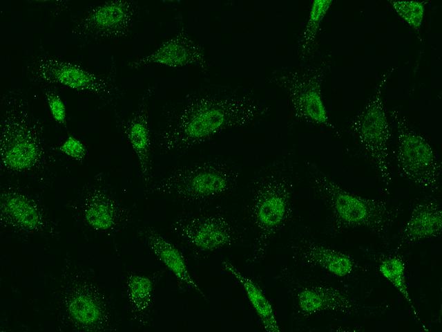 SAP30 Antibody - Immunofluorescence staining of SAP30 in Hela cells. Cells were fixed with 4% PFA, permeabilzed with 0.1% Triton X-100 in PBS, blocked with 10% serum, and incubated with rabbit anti-Human SAP30 polyclonal antibody (dilution ratio 1:500) at 4°C overnight. Then cells were stained with the Alexa Fluor 488-conjugated Goat Anti-rabbit IgG secondary antibody (green). Positive staining was localized to Nucleus.