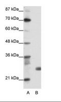 SAP30 Antibody - A: Marker, B: Transfected 293T Cell Lysate.  This image was taken for the unconjugated form of this product. Other forms have not been tested.