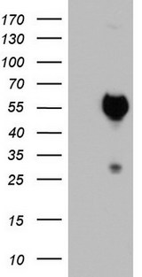 SAP30BP / HTRG Antibody - HEK293T cells were transfected with the pCMV6-ENTRY control (Left lane) or pCMV6-ENTRY SAP30BP (Right lane) cDNA for 48 hrs and lysed. Equivalent amounts of cell lysates (5 ug per lane) were separated by SDS-PAGE and immunoblotted with anti-SAP30BP.