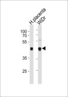 SAP30BP / HTRG Antibody - SAP30BP Antibody western blot of WiDr cell line and human placenta tissue lysates (35 ug/lane). The SAP30BP antibody detected the SAP30BP protein (arrow).