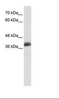 SAP30BP / HTRG Antibody - MCF7 Cell Lysate.  This image was taken for the unconjugated form of this product. Other forms have not been tested.
