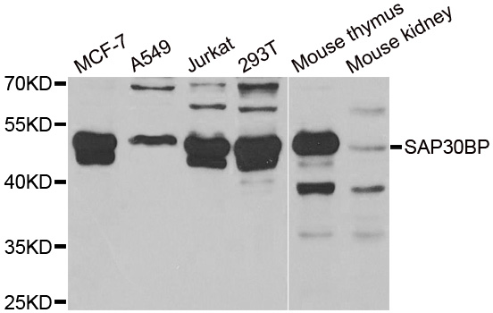 SAP30BP / HTRG Antibody - Western blot analysis of extracts of various cell lines.