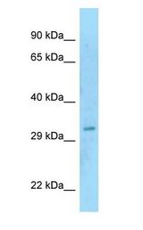 SAP30BP / HTRG Antibody - SAP30BP / HTRG antibody Western Blot of Fetal Stomach.  This image was taken for the unconjugated form of this product. Other forms have not been tested.