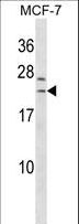 SAP30L Antibody - SAP30L Antibody western blot of MCF-7 cell line lysates (35 ug/lane). The SAP30L antibody detected the SAP30L protein (arrow).
