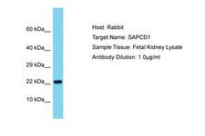 SAPCD1 / C6orf26 Antibody -  This image was taken for the unconjugated form of this product. Other forms have not been tested.