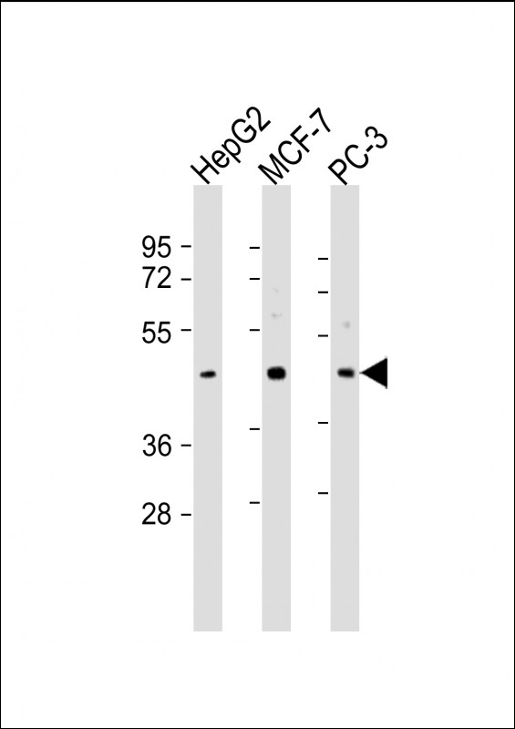 SAPCD2 / C9orf140 Antibody - All lanes: Anti-SAPCD2 Antibody (C-Term) at 1:2000 dilution. Lane 1: HepG2 whole cell lysate. Lane 2: MCF-7 whole cell lysate. Lane 3: PC-3 whole cell lysate Lysates/proteins at 20 ug per lane. Secondary Goat Anti-Rabbit IgG, (H+L), Peroxidase conjugated at 1:10000 dilution. Predicted band size: 43 kDa. Blocking/Dilution buffer: 5% NFDM/TBST.