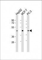 SAPCD2 / C9orf140 Antibody - All lanes: Anti-SAPCD2 Antibody (C-Term) at 1:2000 dilution. Lane 1: HepG2 whole cell lysate. Lane 2: MCF-7 whole cell lysate. Lane 3: PC-3 whole cell lysate Lysates/proteins at 20 ug per lane. Secondary Goat Anti-Rabbit IgG, (H+L), Peroxidase conjugated at 1:10000 dilution. Predicted band size: 43 kDa. Blocking/Dilution buffer: 5% NFDM/TBST.