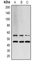 SAPK / JNK / MAPK8 + MAPK9 + MAPK10 Antibody - Western blot analysis of JNK1/2/3 expression in LOVO (A); PC12 (B); rat muscle (C) whole cell lysates.