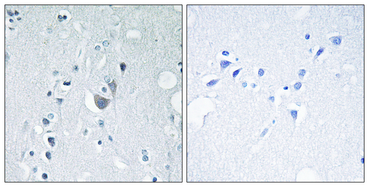 SAPK / JNK / MAPK8 + MAPK9 + MAPK10 Antibody - Immunohistochemistry analysis of paraffin-embedded human brain, using SAPK/JNK (Phospho-Tyr185) Antibody. The picture on the right is blocked with the phospho peptide.