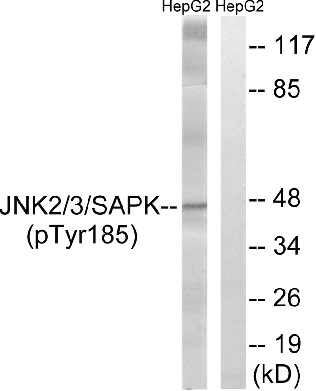 SAPK / JNK / MAPK8 + MAPK9 + MAPK10 Antibody - Western blot analysis of lysates from HepG2 cells treated with nocodazole 1ug/ml 16h, using SAPK/JNK (Phospho-Tyr185) Antibody. The lane on the right is blocked with the phospho peptide.