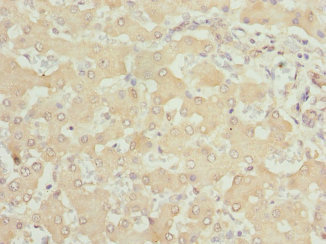 SAR1A / SAR1 Antibody - Immunohistochemistry of paraffin-embedded human liver tissue at dilution 1:100