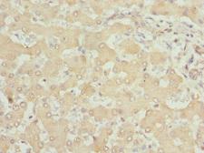 SAR1A / SAR1 Antibody - Immunohistochemistry of paraffin-embedded human liver tissue at dilution 1:100