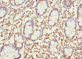 SAR1A / SAR1 Antibody - Immunohistochemistry of paraffin-embedded human small intestine tissue at dilution 1:100