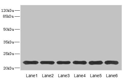 SAR1A / SAR1 Antibody - Western blot All Lanes: SAR1A antibody at 4.57ug/ml Lane 1: Mouse lung tissue Lane 2: NIH/3T3 whole cell lysate Lane 3: A431 whole cell lysate Lane 4: MCF7 whole cell lysate Lane 5: Jurkat whole cell lysate Lane 6: HepG-2 whole cell lysate Secondary Goat polyclonal to Rabbit IgG at 1/10000 dilution Predicted band size: 23,18 kDa Observed band size: 22 kDa