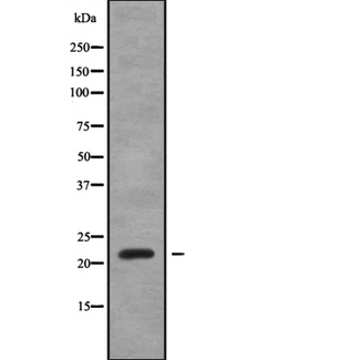 SAR1A / SAR1 Antibody - Western blot analysis SAR1A using HeLa whole cells lysates