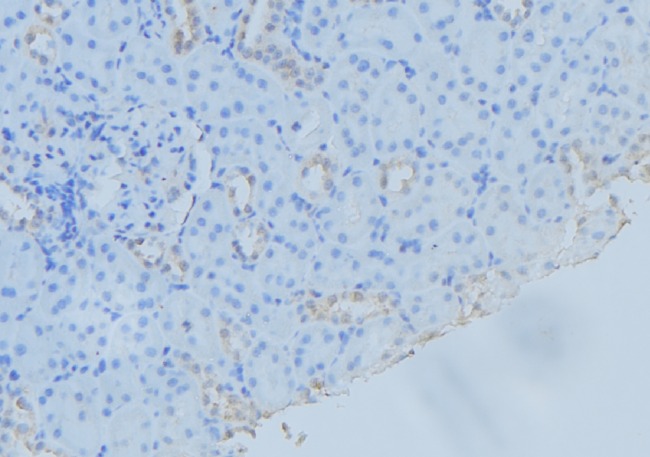 SAR1A / SAR1 Antibody - 1:100 staining mouse kidney tissue by IHC-P. The sample was formaldehyde fixed and a heat mediated antigen retrieval step in citrate buffer was performed. The sample was then blocked and incubated with the antibody for 1.5 hours at 22°C. An HRP conjugated goat anti-rabbit antibody was used as the secondary.