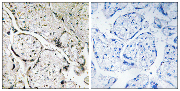 SARA2 / SAR1B Antibody - Immunohistochemistry analysis of paraffin-embedded human placenta tissue, using SAR1B Antibody. The picture on the right is blocked with the synthesized peptide.