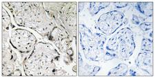 SARA2 / SAR1B Antibody - Immunohistochemistry analysis of paraffin-embedded human placenta tissue, using SAR1B Antibody. The picture on the right is blocked with the synthesized peptide.