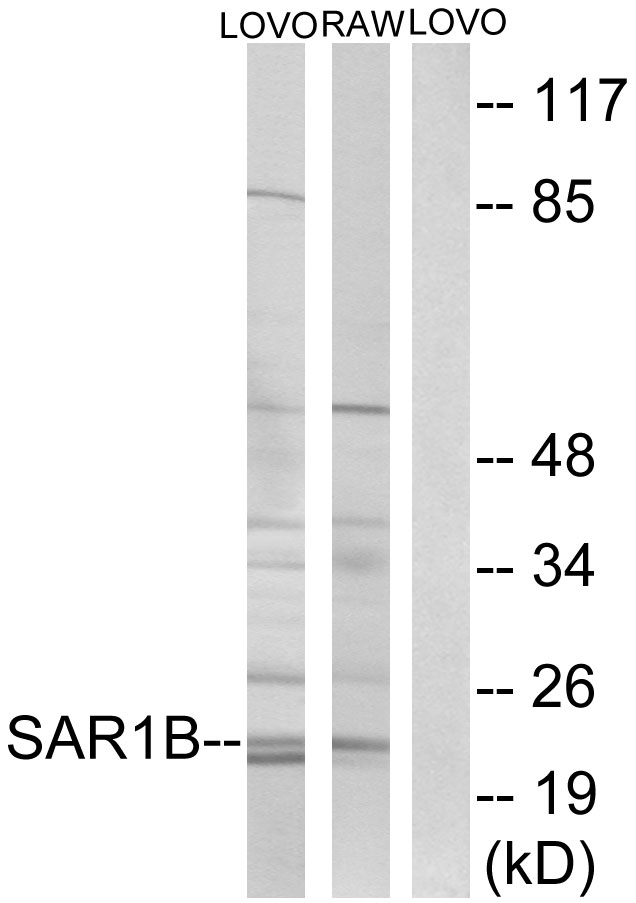 SARA2 / SAR1B Antibody - Western blot analysis of lysates from LOVO and RAW264.7 cells, using SAR1B Antibody. The lane on the right is blocked with the synthesized peptide.