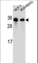 SARA2 / SAR1B Antibody - SAR1B Antibody western blot of MCF-7,MDA-MB453 cell line lysates (35 ug/lane). The SAR1B antibody detected the SAR1B protein (arrow).