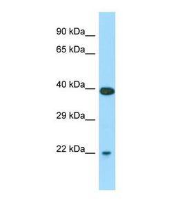 SARA2 / SAR1B Antibody - Western blot of Mouse Stomach. Sar1b antibody dilution 1.0 ug/ml.  This image was taken for the unconjugated form of this product. Other forms have not been tested.