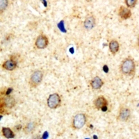 SARA2 / SAR1B Antibody - Immunohistochemical analysis of SAR1B staining in human brain formalin fixed paraffin embedded tissue section. The section was pre-treated using heat mediated antigen retrieval with sodium citrate buffer (pH 6.0). The section was then incubated with the antibody at room temperature and detected with HRP and DAB as chromogen. The section was then counterstained with hematoxylin and mounted with DPX.