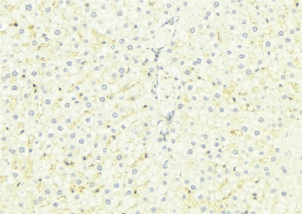 SARA2 / SAR1B Antibody - 1:100 staining mouse liver tissue by IHC-P. The sample was formaldehyde fixed and a heat mediated antigen retrieval step in citrate buffer was performed. The sample was then blocked and incubated with the antibody for 1.5 hours at 22°C. An HRP conjugated goat anti-rabbit antibody was used as the secondary.