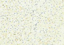 SARA2 / SAR1B Antibody - 1:100 staining mouse liver tissue by IHC-P. The sample was formaldehyde fixed and a heat mediated antigen retrieval step in citrate buffer was performed. The sample was then blocked and incubated with the antibody for 1.5 hours at 22°C. An HRP conjugated goat anti-rabbit antibody was used as the secondary.