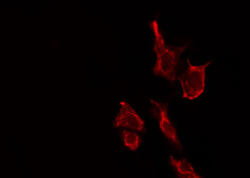 SARA2 / SAR1B Antibody - Staining LOVO cells by IF/ICC. The samples were fixed with PFA and permeabilized in 0.1% Triton X-100, then blocked in 10% serum for 45 min at 25°C. The primary antibody was diluted at 1:200 and incubated with the sample for 1 hour at 37°C. An Alexa Fluor 594 conjugated goat anti-rabbit IgG (H+L) antibody, diluted at 1/600, was used as secondary antibody.