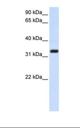 SARAF / TMEM66 Antibody - Transfected 293T cell lysate. Antibody concentration: 1.0 ug/ml. Gel concentration: 12%.  This image was taken for the unconjugated form of this product. Other forms have not been tested.